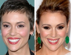 Alyssa Milano Breast Implants Before And After Plastic Surgery3