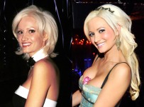 Holly Madison Plastic Surgery Before and After Look Photos