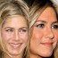 Best Celebrity Nose Jobs Before And After Pictures