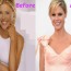 Julie Bowen Fraxel Cosmetic Surgery Before and After Nose Job