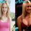 Kaley Cuoco Breast Implant Nose Job Plastic Surgery Before And After Photos