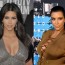 Kim Kardashian Breast Implants Before And After Pictures