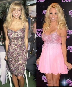 Pamela Anderson Plastic Surgery Before And After photos