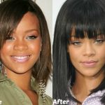 Rihanna Nose Job Plastic Surgery Before And After Pictures 3