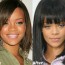 Rihanna Nose Job Plastic Surgery Before And After Pictures 3