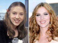 Scarlett Johansson Plastic Surgery Before and After