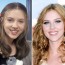Scarlett Johansson Plastic Surgery Before and After