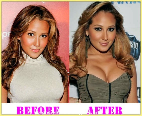 Adrienne Bailon Breast Implants Plastic Surgery Before and After Photos 