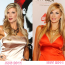 Alexis Bellino plastic surgery Before and After Photos