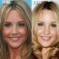 Amanda Bynes Plastic Surgery Before And After Photos