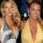 Blake Lively Plastic Surgery Before And After Photos