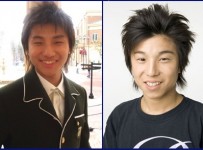 Daesung Plastic Surgery Before And After Pictures1