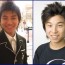Daesung Plastic Surgery Before And After Pictures1