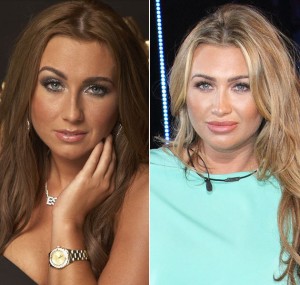 Lauren Goodger Plastic Surgery Before And After Photos 