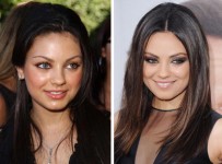 Best Celebrity Nose Jobs Before And After Pictures