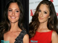 Minka Kelly plastic surgery before and after photos1