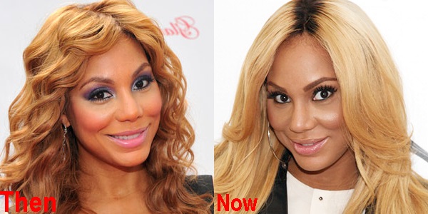 Tamar Braxton Nose Job Plastic Surgery Before And After Pictures