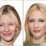 cate blanchett plastic surgery before and after