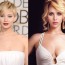 jennifer lawrence Plastic Surgery Before and After Face