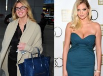 kate upton breast implants plastic surgery before and after photos1