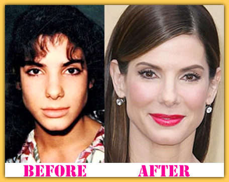 sandra bullock plastic surgery before and after photos