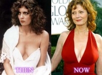 susan sarandon plastic surgery before and after pictures
