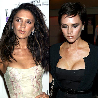 victoria beckham plastic surgery before and after photos