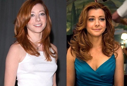 Alyson Hannigan Breast Implants plastic Surgery Before and After Photos