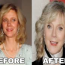 Blythe Danner plastic surgery before and after photos