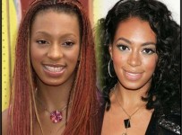 Ciara Nose Job Plastic Surgery Before and After Photos, Pictures