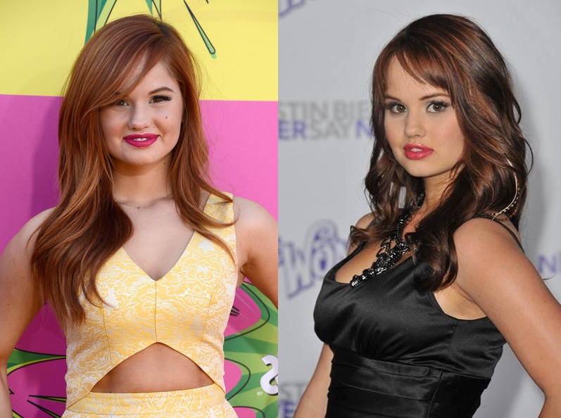Debby Ryan Breast Implants Before and After plastic Surgery11