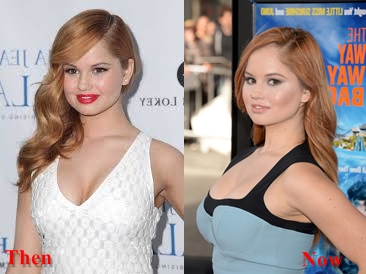 Debby Ryan Breast Implants Before and After plastic Surgery111