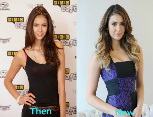 Nina Dobrev Plastic Surgery Before and After Nose Job Photos1