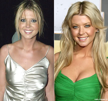 Tara Reid plastic Surgery Before and After Photos, Pictures
