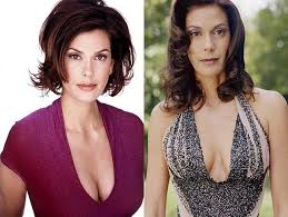 Teri Hatcher Plastic Surgery Before and After Breast Implants and Facelift1