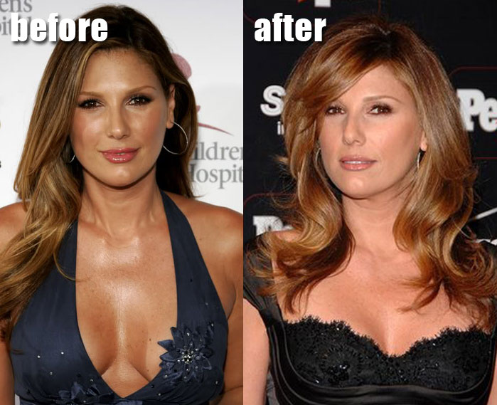 Daisy Fuentes Breast Implants Plastic Surgery Before and After Boobs Job,