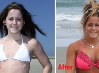 Jenelle Evans Breat Implants plastic Surgery Before and After Boobs Job