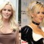 Jenny McCarthy Breast Implants plastic Surgery Before and After Boobs Job