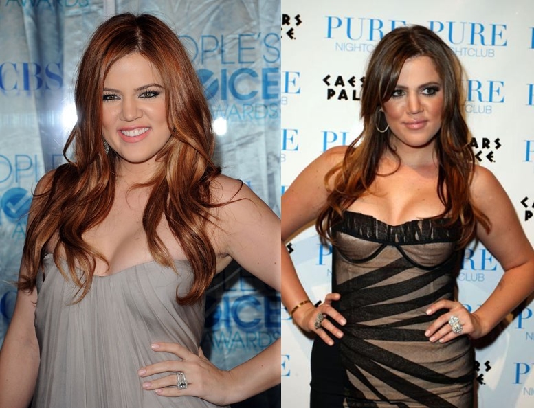 Khloe Kardashian Breast Implants Plastic Surgery before and After boob pics