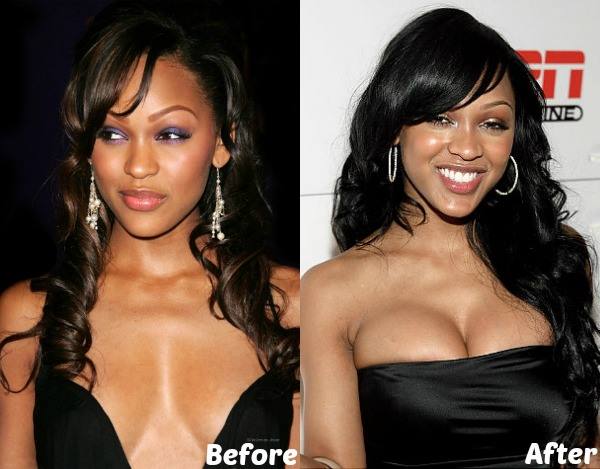 Meagan Good breast Implants Plastic Surgery Before and After Boobs Job photos