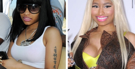 Nicki Minaj Breast Implants Plastic Surgery Boobs Job Before And After Photo