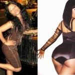 Nicki Minaj Butt Implants Plastic Surgery Before And After Photos