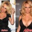 Pamela Anderson breast implants Surgery Before and After Boob Job