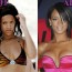 Rihanna Boobs Job plastic Surgery Before and After breast implants Photos