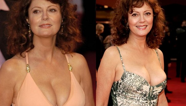 Susan Sarandon Breast Implants Plastic Surgery Before And After Boobs Job