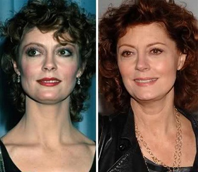 Susan Sarandon Breast Implants Plastic Surgery Before And After Boobs Job photos