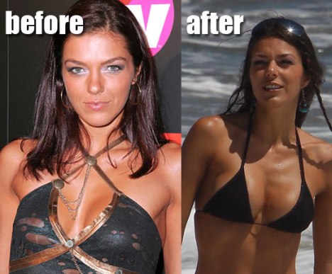 Adrianne Curry Breast Implants plastic Surgery Before and After Boobs Job