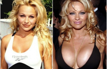 Coco Austin breast implants plastic surgery before and after boobs job,