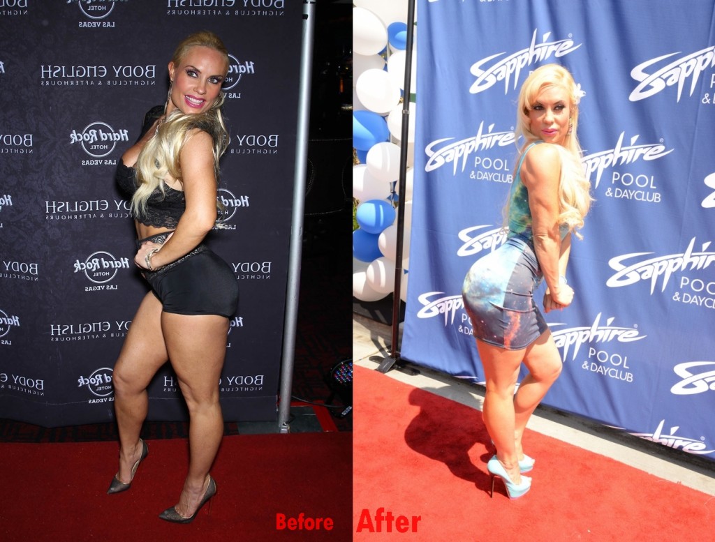 Coco Austin butt implants plastic surgery before and after photos