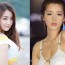 Im Ji Hye plastic surgery before and after photos